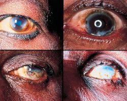 5634399336_8737e9fb2b_o